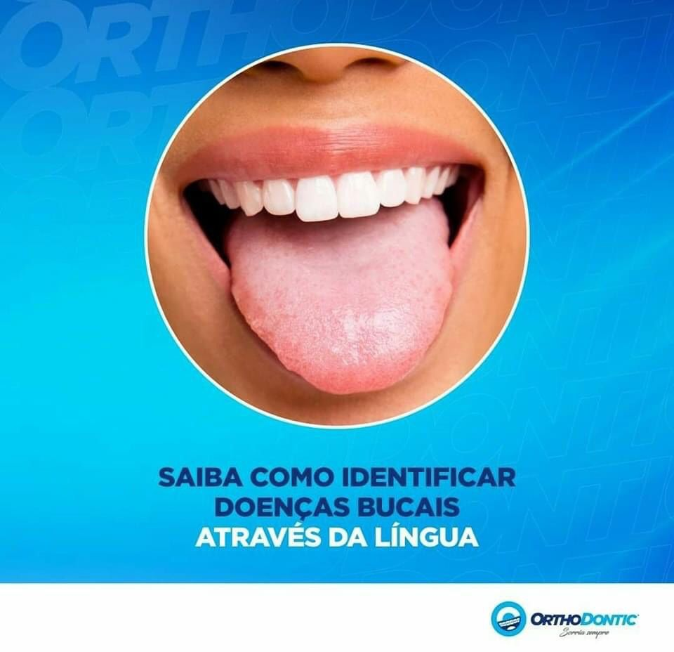 Orthodontic Rio Negrinho explica como identificar doenças bucais através da língua Nossas